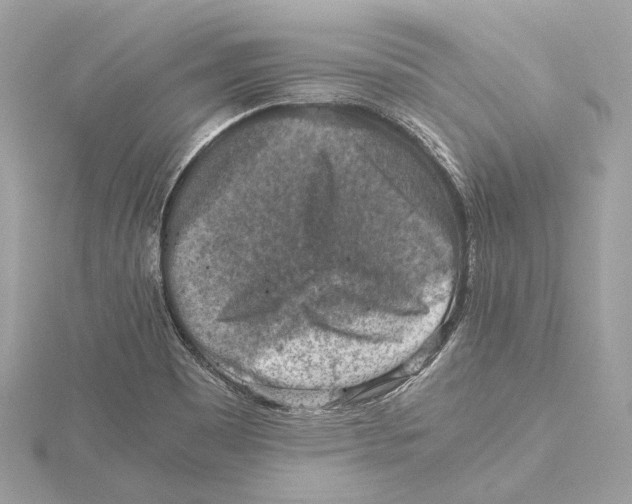 X0000115411465200912011215