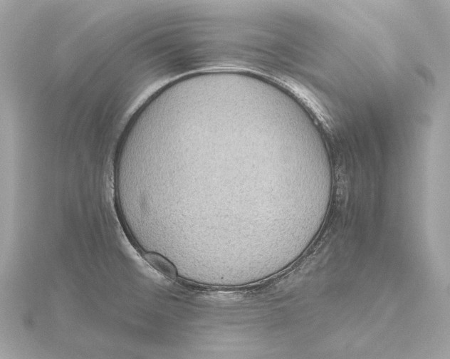 X0000115411476200912011215