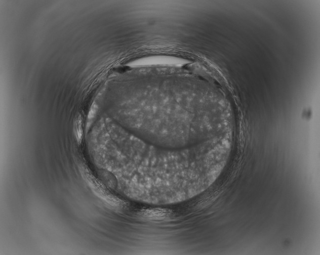 X0000115410069200912011350