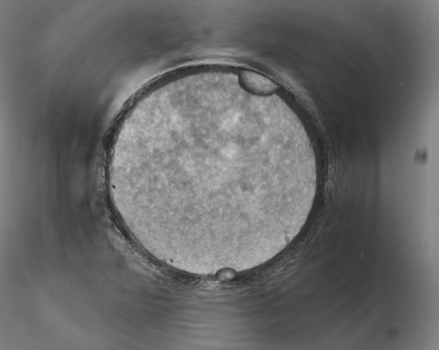 X0000115411360200912011330