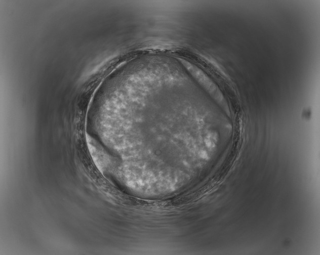 X0000115411399200912011329