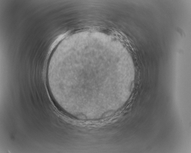 X0000115410003200912151551