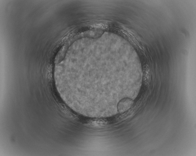 X0000115410466200912151545