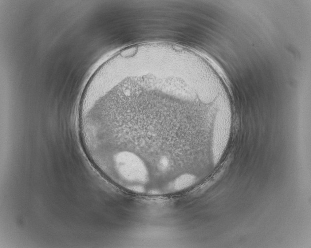 X0000115410957200912151538