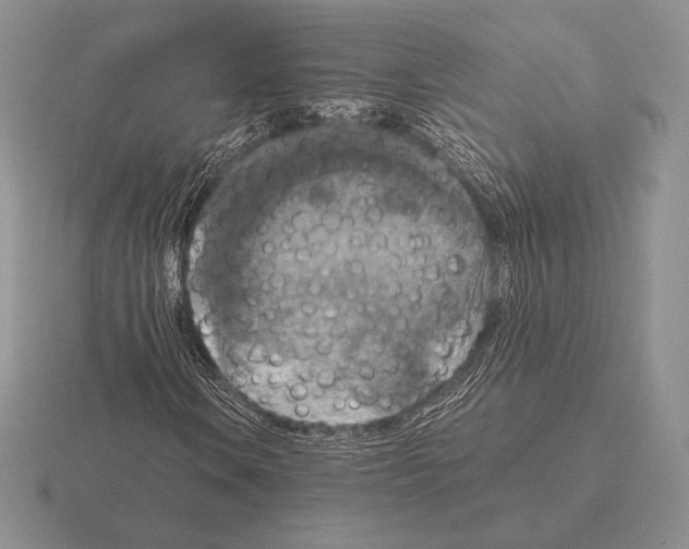 X0000115411106200912151535