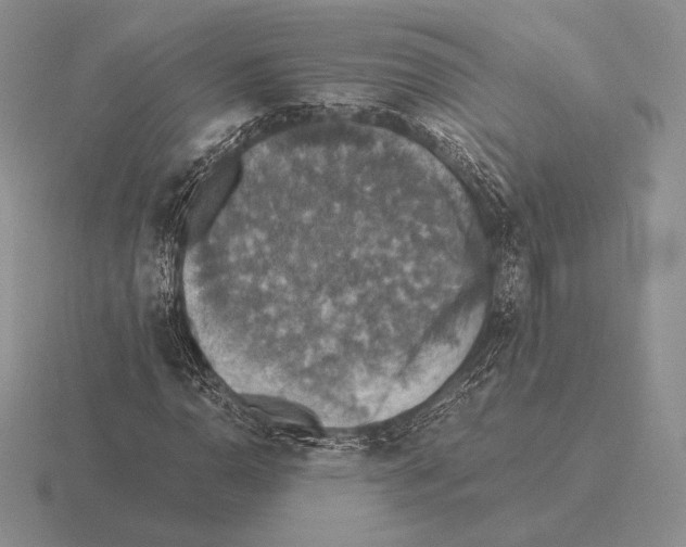 X0000115411110200912151535