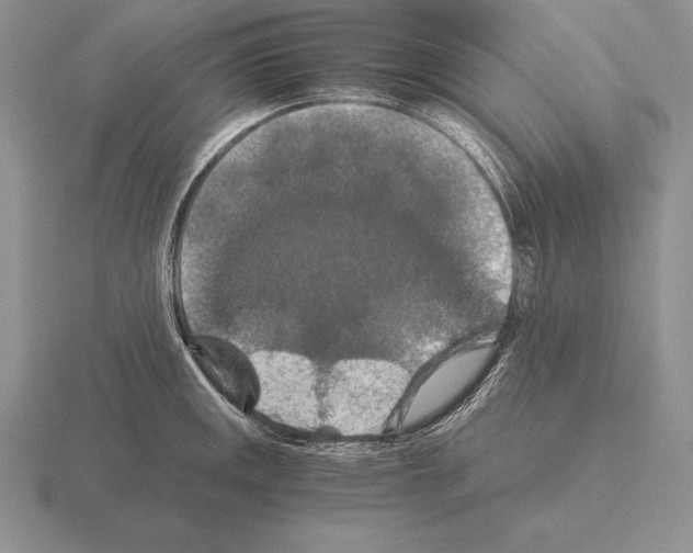 X0000115411141200912151536