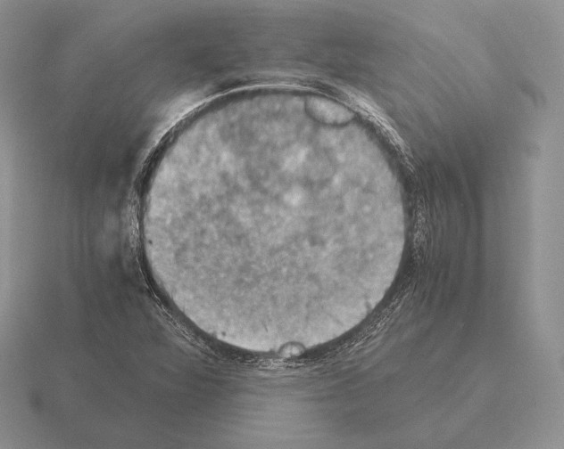 X0000115411360200912151532