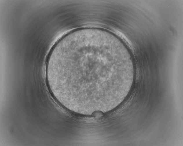 X0000115411376200912151532