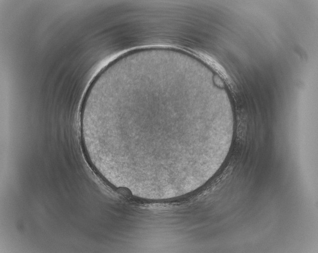 X0000115411380200912151532