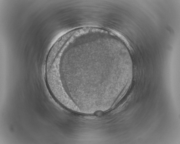 X0000115411383200912151532