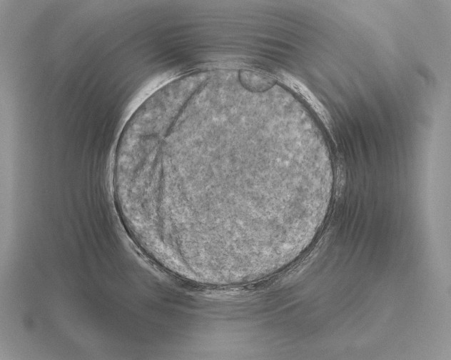 X0000115411386200912151532