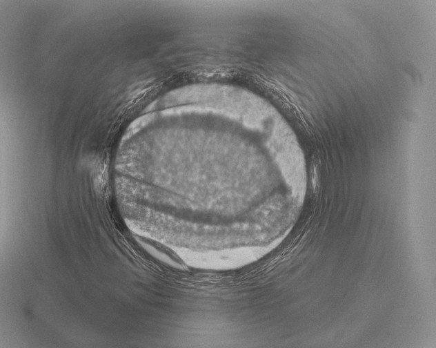 X0000115411396200912151531