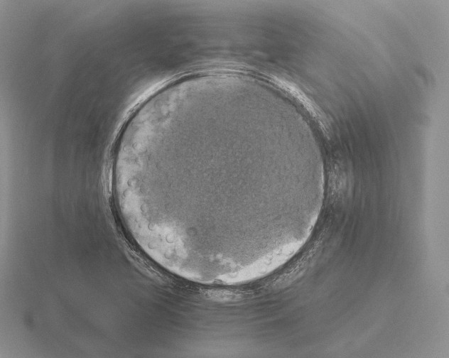 X0000115411413200912151531