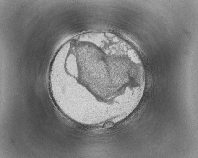 X0000115411471200912151531