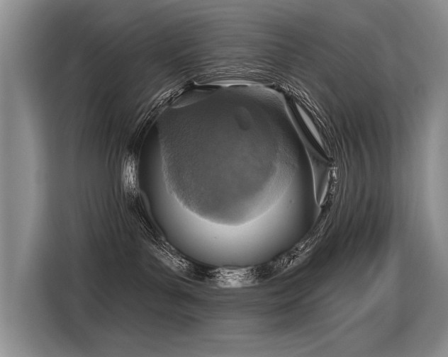 X0000115420143200911101639