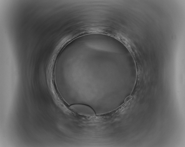 X0000115420145200911101638