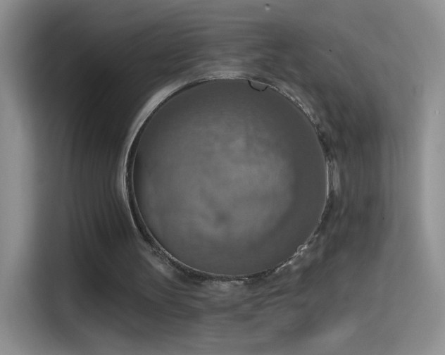 X0000115420147200911101638