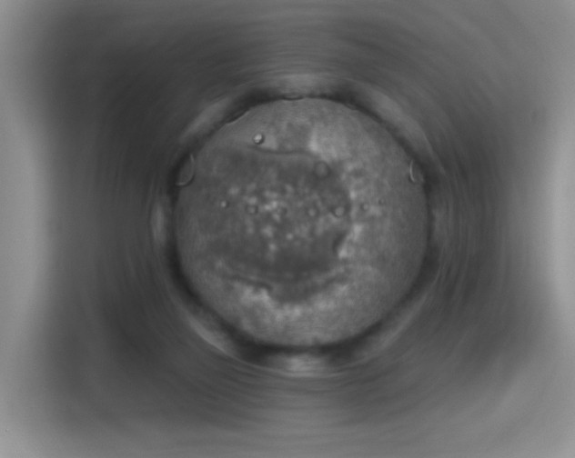 X0000115420165200911101638