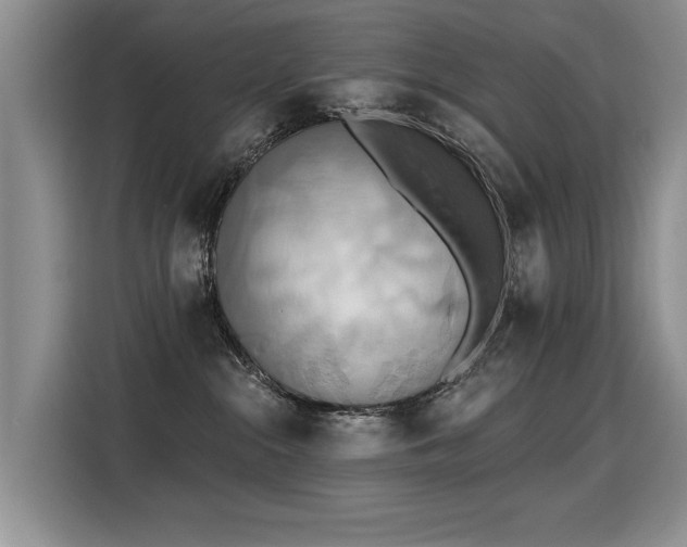 X0000115420284200911101638