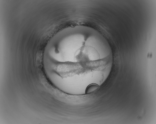 X0000115420030200911171434