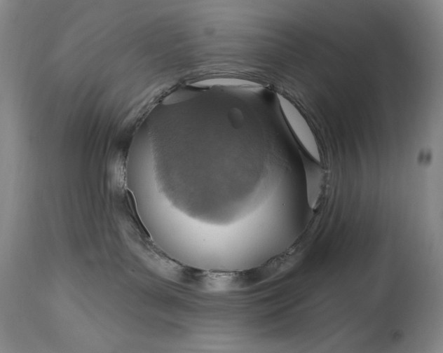 X0000115420143200911171431