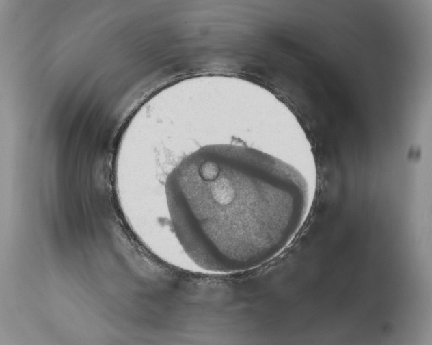 X0000115420146200911171431