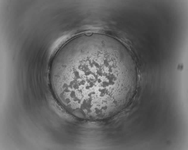 X0000115420149200911171431