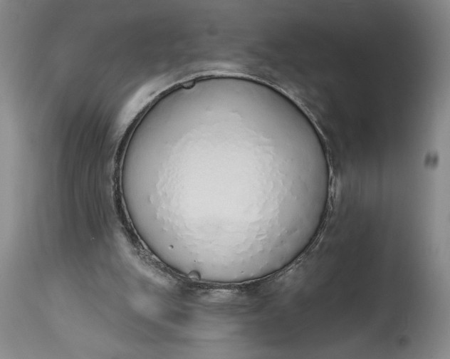 X0000115420151200911171431