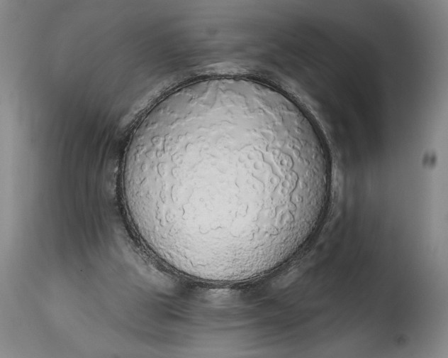 X0000115420153200911171431