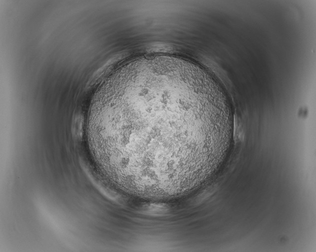 X0000115420157200911171431