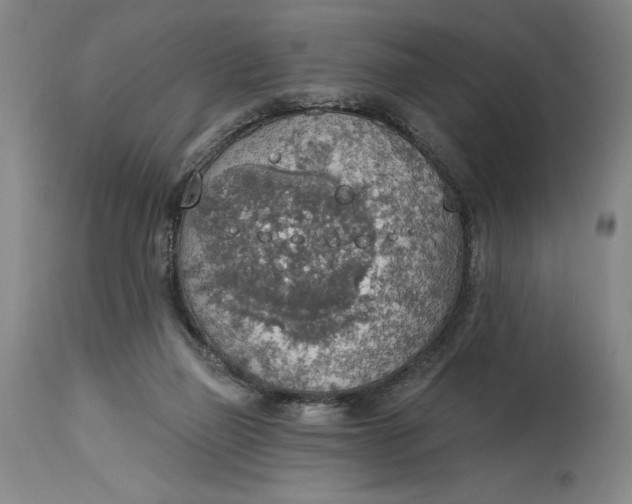 X0000115420165200911171431