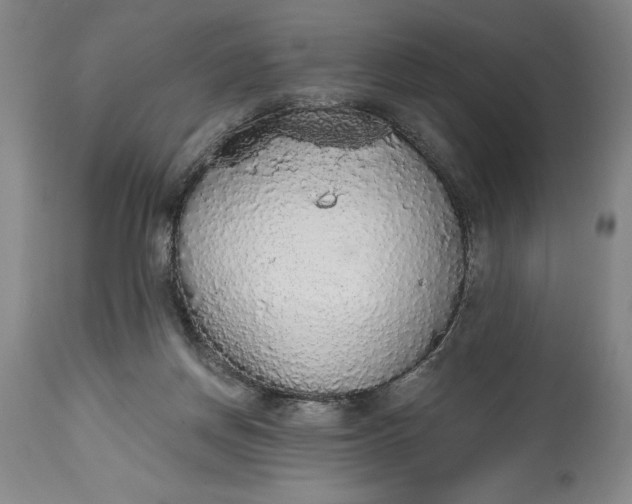 X0000115420166200911171431