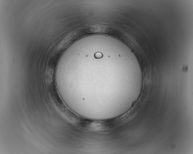 X0000115420171200911171431