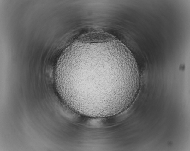 X0000115420178200911171431