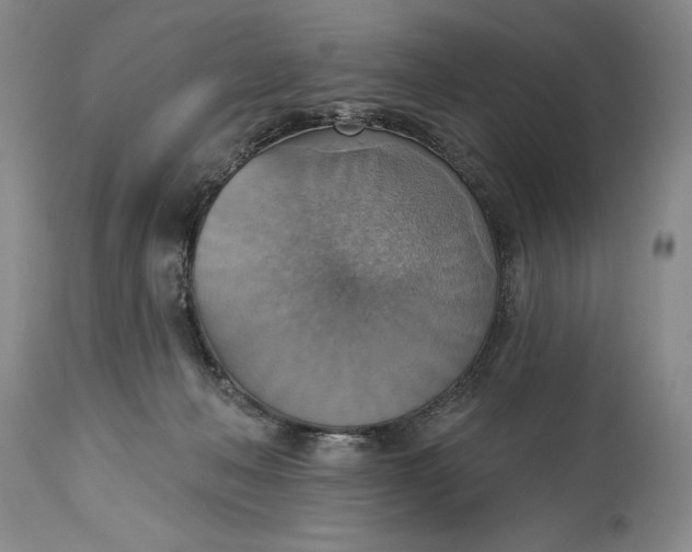 X0000115420222200911171430