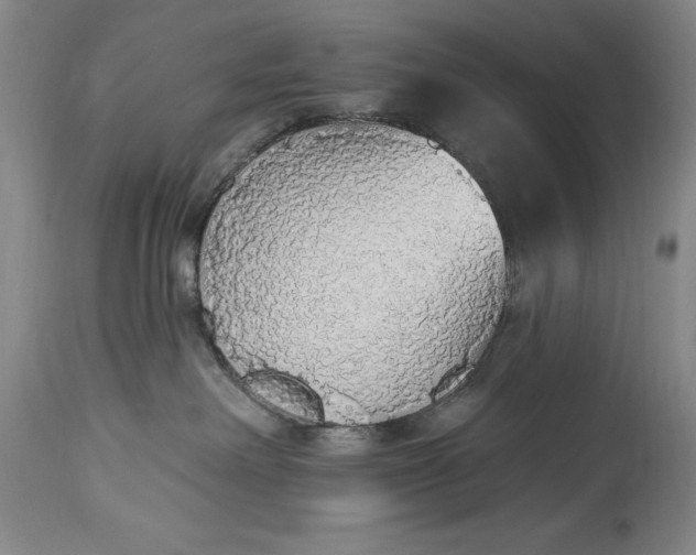 X0000115420238200911171430