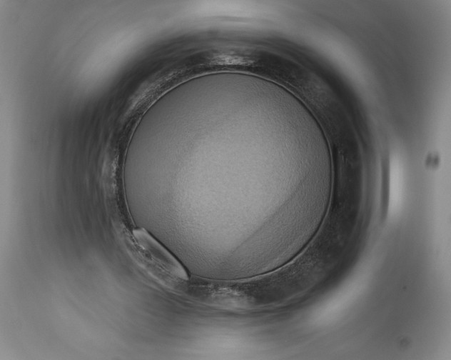 X0000115420387200911171428