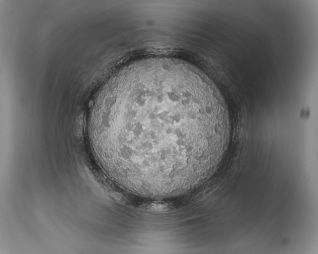 X0000115420647200911171424