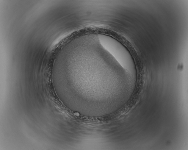 X0000115420919200911171420