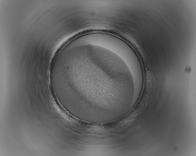 X0000115420935200911171420