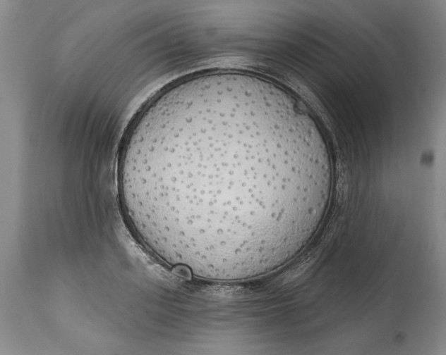 X0000115420939200911171420