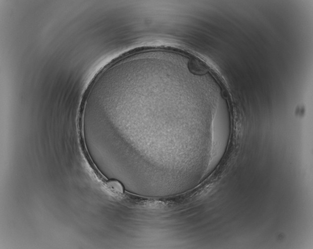 X0000115420943200911171420