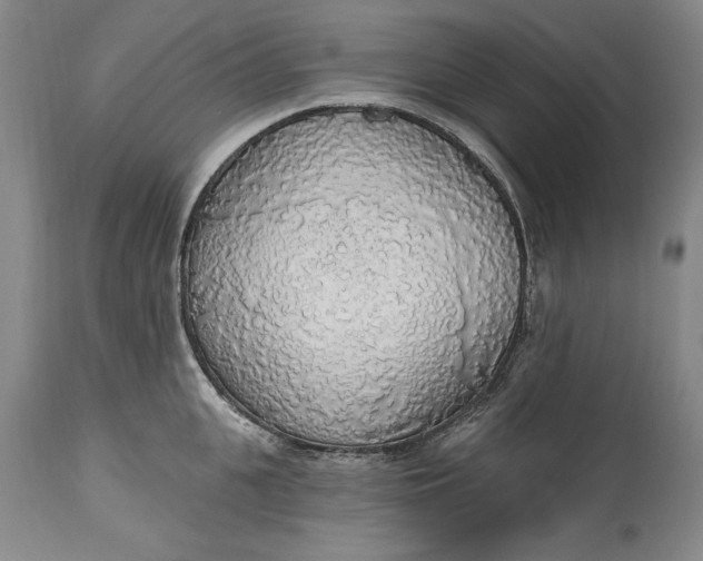 X0000115420951200911171420