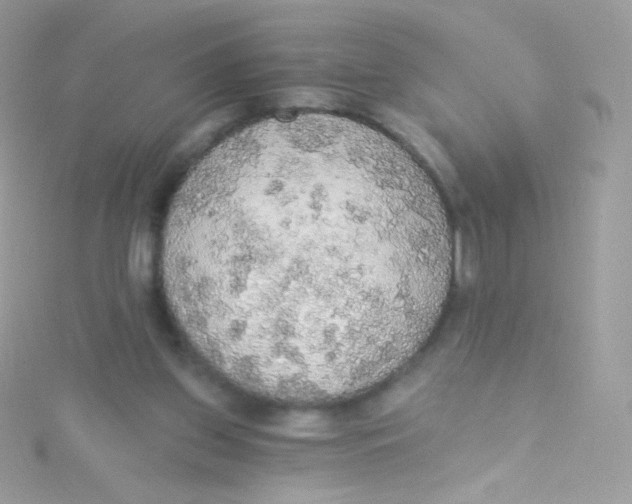 X0000115420157200911241355