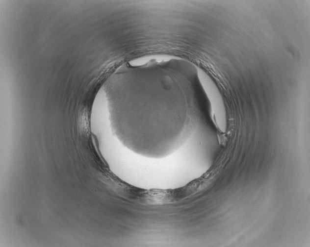 X0000115420143200912011334