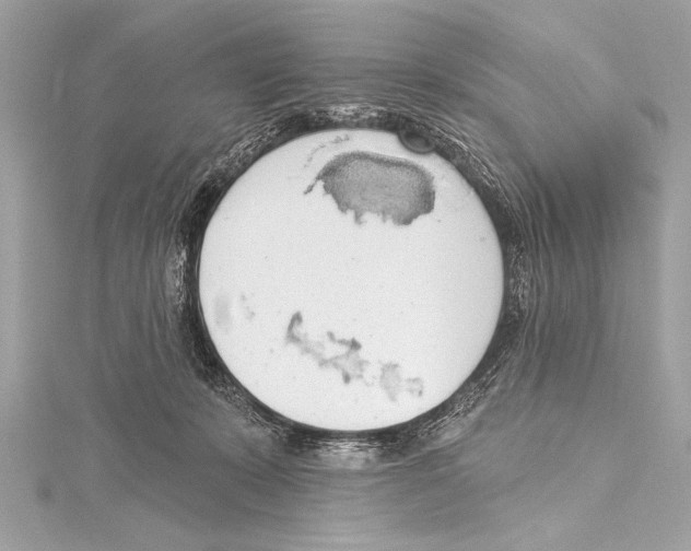 X0000115420319200912011332