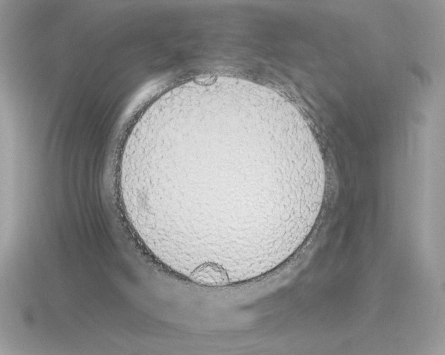 X0000115420006200912151613