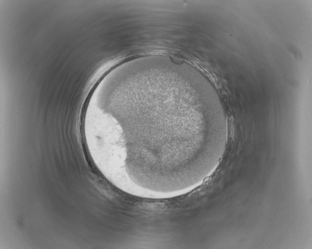 X0000115420147200912151610