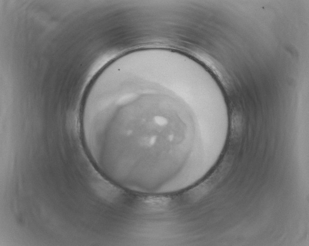 X0000115421466200912151553